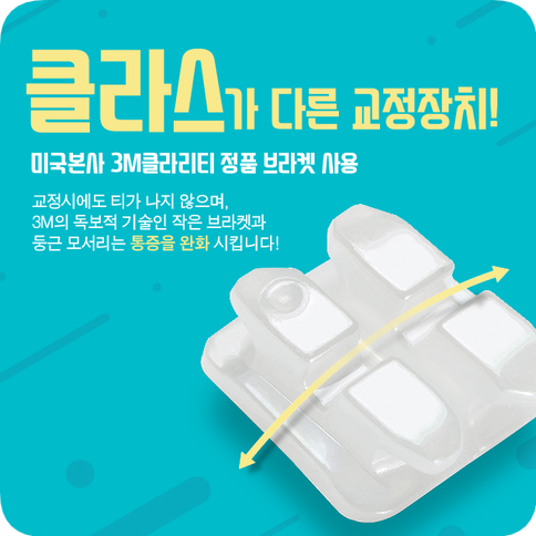 반대교합 관련 이미지 12