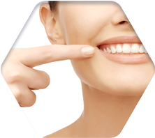 세라믹교정 세라믹치과 클리피씨교정 이야기 관련 이미지 9