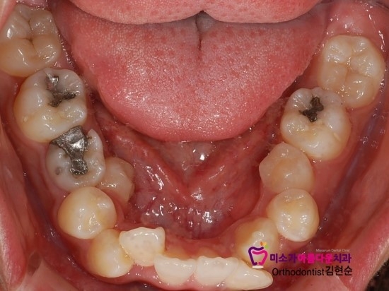 논현동교정잘하는치과 미소가아름다운치과 고객님 후기입니다 관련 이미지 5