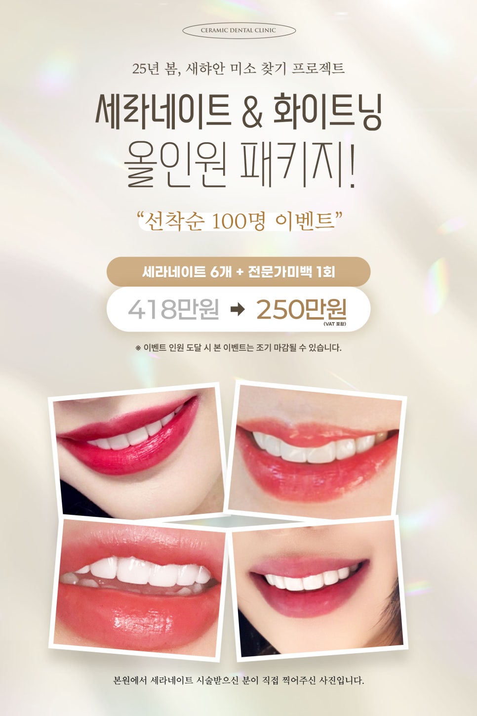 무삭제라미네이트 , 세라네이트가 궁금하다면? 관련 이미지 13