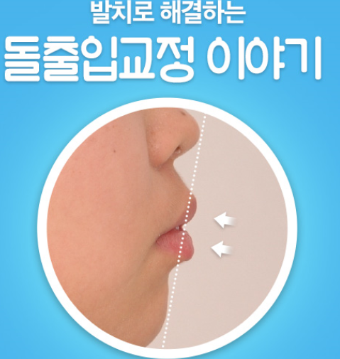 학동역치과 세라믹치과 교정리얼스토리 관련 이미지 2
