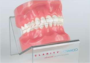 세라믹교정 세라믹치과 세밀하고 정확하게! 더 아름답고 건강한 치아를 만듭니다. 관련 이미지 4