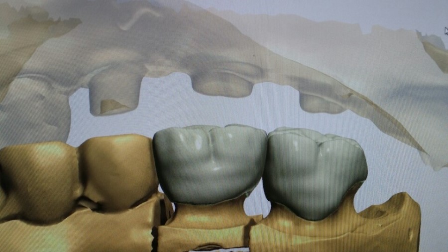 [미소가아름다운치과 양재유]  디지털 기공소 운영 관련 이미지 16