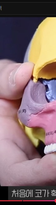 강남치아교정, 악궁확장하면 얼굴크기 커질까? 관련 이미지 9