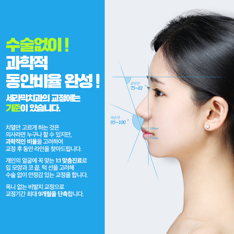 학동역 치아교정 3M 클래러티 어드밴스 관련 이미지 4