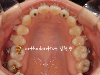 강남교정치과 관련 이미지 19