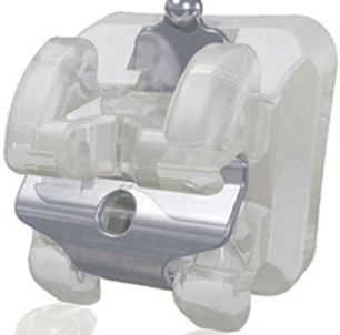 강남 교정치과 클리피씨 교정이 비싼 이유 관련 이미지 5