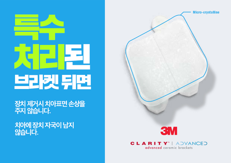 세라믹치과 세라믹교정은 미국3M에서 만든 브라켓 관련 이미지 9