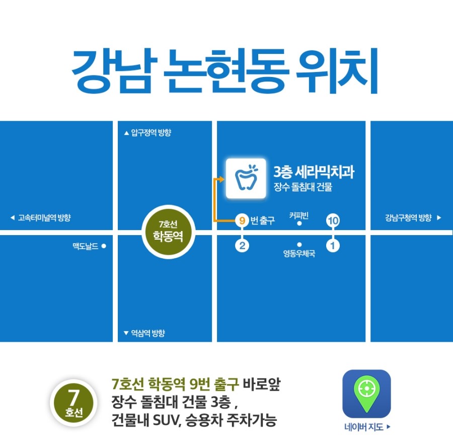 세라믹교정 이벤트 관련 이미지 14