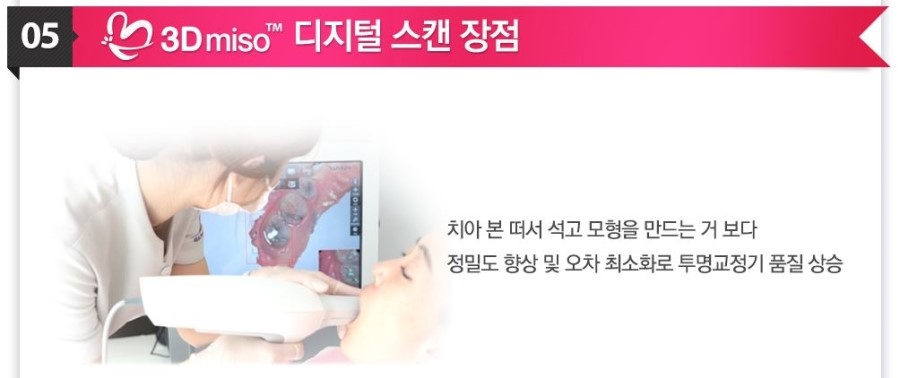 [ 학동역 치과 ] 투명교정의 새이름 3D miso 교정 관련 이미지 7