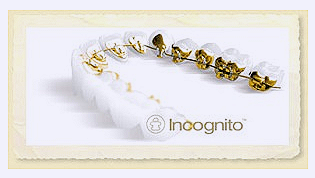 강남 세라믹 교정 관련 이미지 11