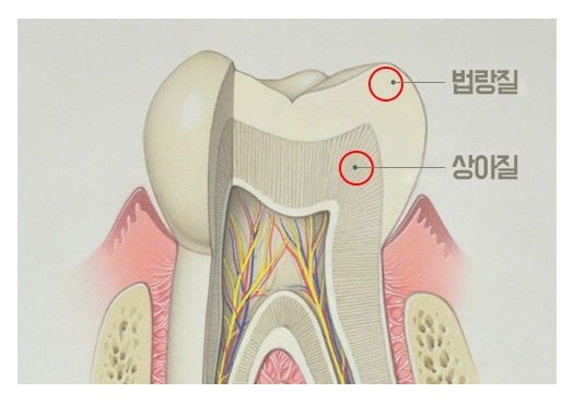 비발치교정 무조건 좋은 것만은 아니다? 관련 이미지 3
