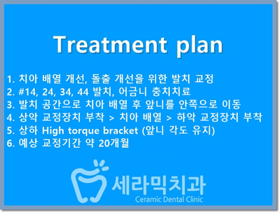 토끼이빨 돌출입 치아교정 전후 표정변화! 관련 이미지 9