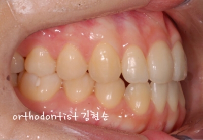 강남교정치과 관련 이미지 33