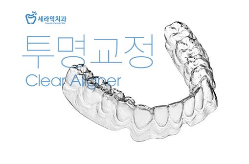 투명교정후기 세라믹치과 ~ 관련 이미지 6