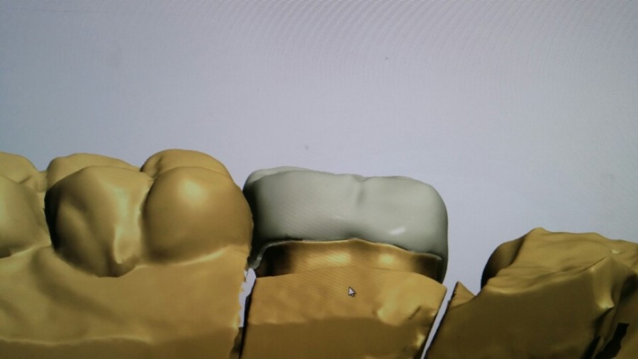 [미소가아름다운치과 양재유]  디지털 기공소 운영 관련 이미지 8