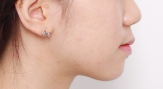 3D 스캐너를 이용한 교정 심뮬레이션 관련 이미지 5