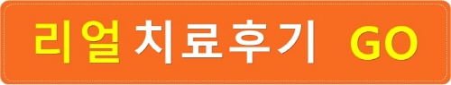치아교정전후 영상 : 돌출입과 중심선비대칭 인상변화 관련 이미지 4