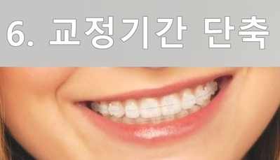 세라믹교정 잘하는 곳은? 세라믹치과 관련 이미지 17