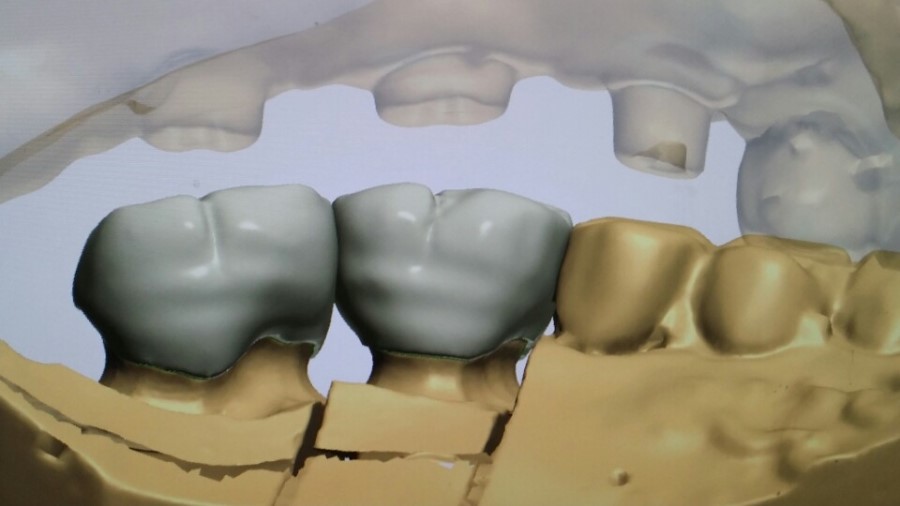 [미소가아름다운치과 양재유]  디지털 기공소 운영 관련 이미지 14