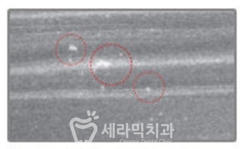 교정기 세정 세척제, 거품치약, 티드클린얼라인 관련 이미지 2