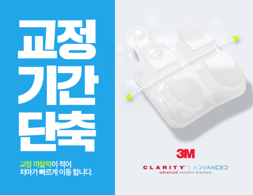 강남 덧니 관련 이미지 21