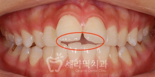 우리 아이 관련 이미지 2