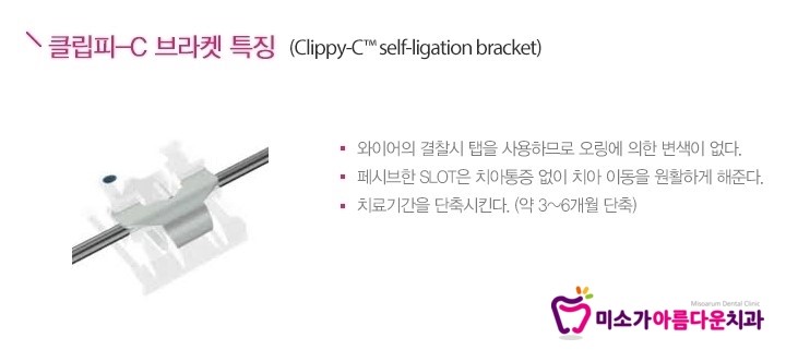 학동역치아교정치과 미소가아름다운치과의 교정창지 관련 이미지 1