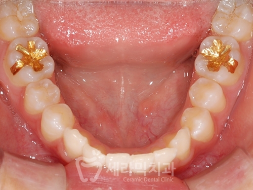 우리 아이 관련 이미지 8