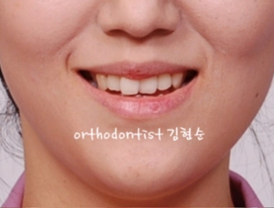 강남교정치과 관련 이미지 2