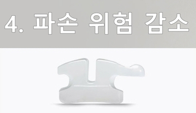 세라믹교정 잘하는 곳은? 세라믹치과 관련 이미지 15