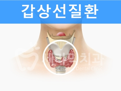 치아교정 부작용 제대로 알기 1. 관련 이미지 9