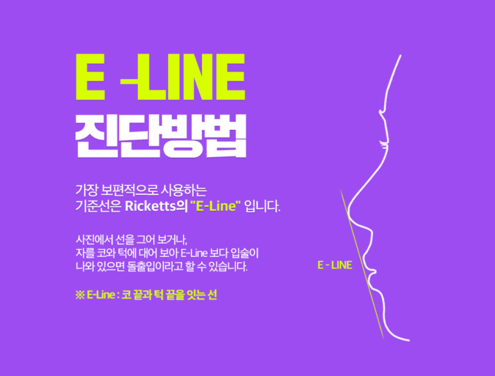 세라믹치아교정만 19년째 관련 이미지 6