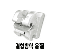 클리피씨교정 기간 짧을까? 관련 이미지 6