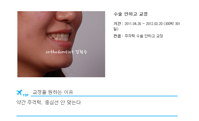 주걱턱수술 안하고 양악수술 안하고 관련 이미지 5