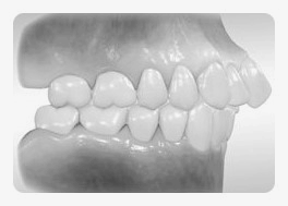 학동역치과 하면 세라믹교정 ~ 관련 이미지 10