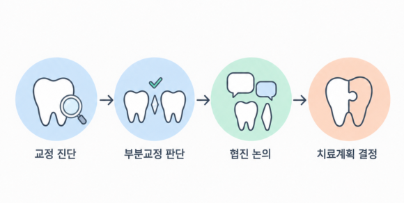 치아 사이 검은 틈, 블랙트라이앵글 치료 방법과 내게 맞는 선택은? 관련 이미지 3