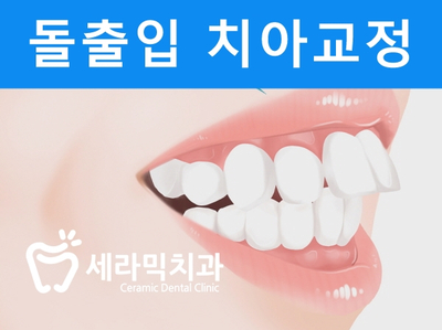 돌출입 치아교정 사례(학동역 치아교정 세라믹치과) 관련 이미지 1