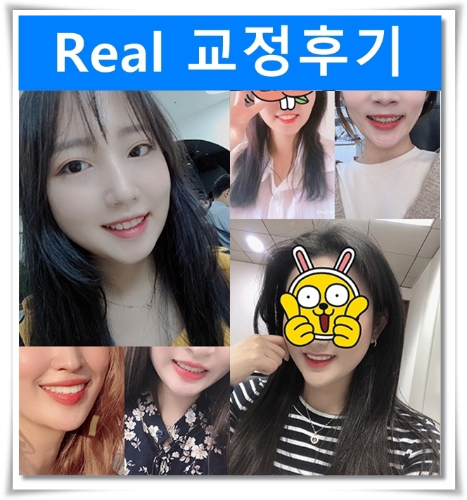 치아교정은 치아교정전문의에게 맡기세요! 관련 이미지 6