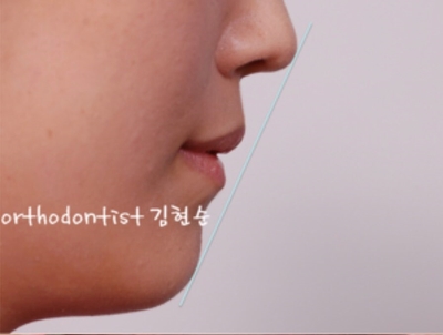 강남교정치과 관련 이미지 8