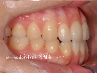 강남교정치과 관련 이미지 26