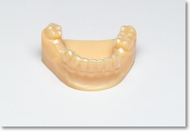 세라믹교정 세라믹치과 - 아나운서 교정이 뭘까요 ? 관련 이미지 8