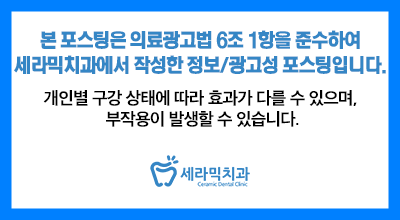 상실된 치아가 있어도, 금니가 있어도 치아교정전후는 계속된다! 관련 이미지 13