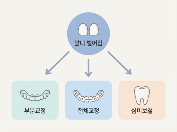 앞니 벌어짐 교정, 단순히 빈틈만 조이면 끝일까요? 교정과 전문의의 시선 관련 이미지 2
