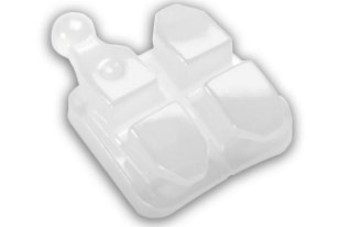 학동역교정치과 세라믹치과 세라믹교정 관련 이미지 5