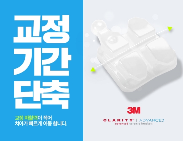 학동역 교정치과, 세라믹치과의 세라믹교정 관련 이미지 5