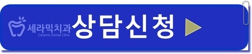 벌어진 앞니, 최소삭제 라미네이트 전후 관련 이미지 6