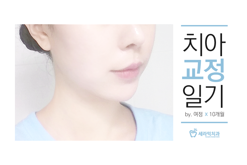 세라믹치과 치아교정일기 - 김여정 관련 이미지 2