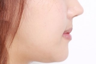 세라믹치과  교정리얼 스토리 관련 이미지 4