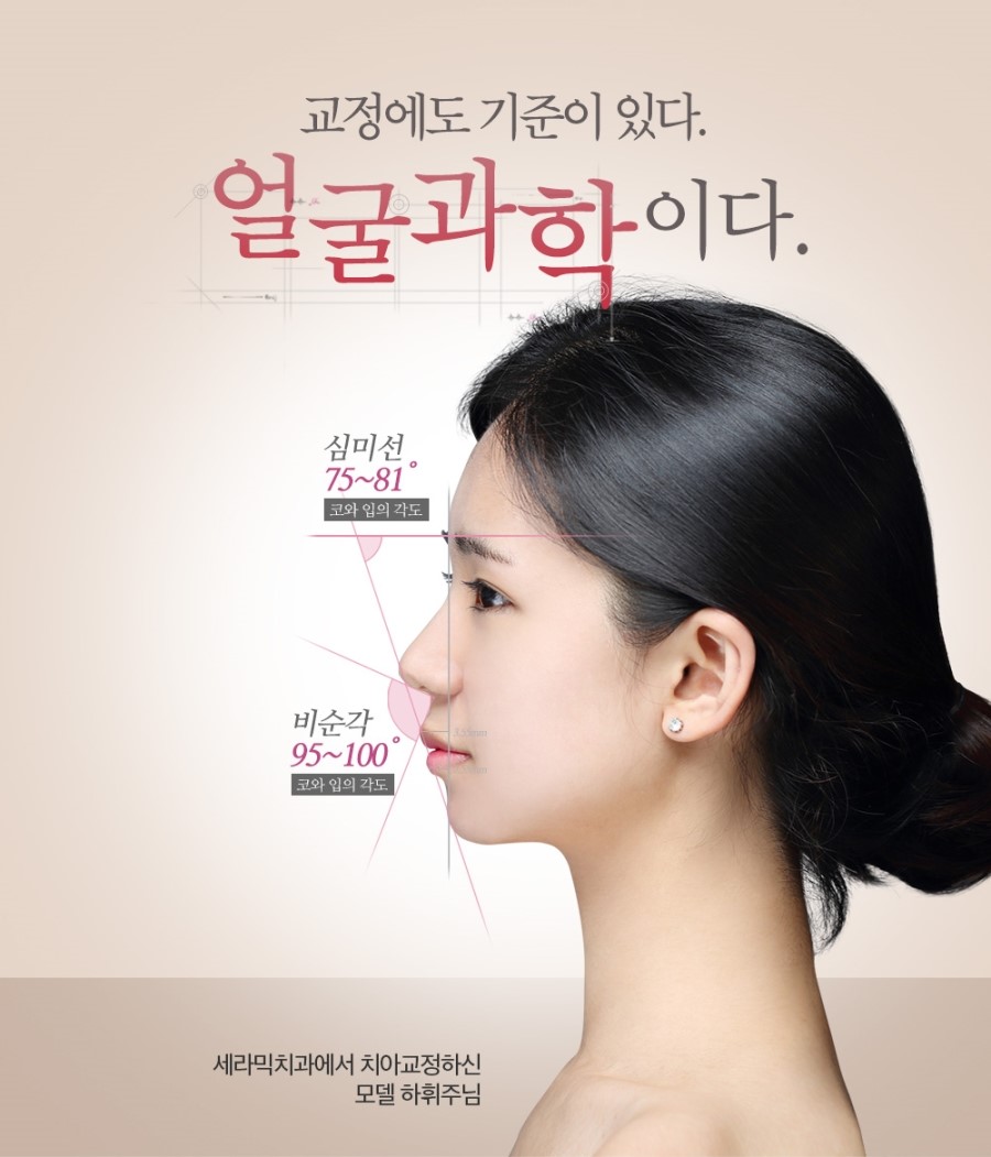 세라믹교정 이벤트 관련 이미지 5